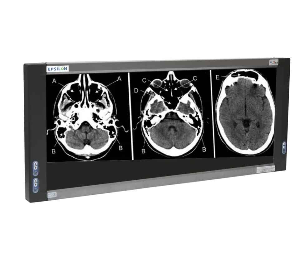 Led Triple View Box Epsilon